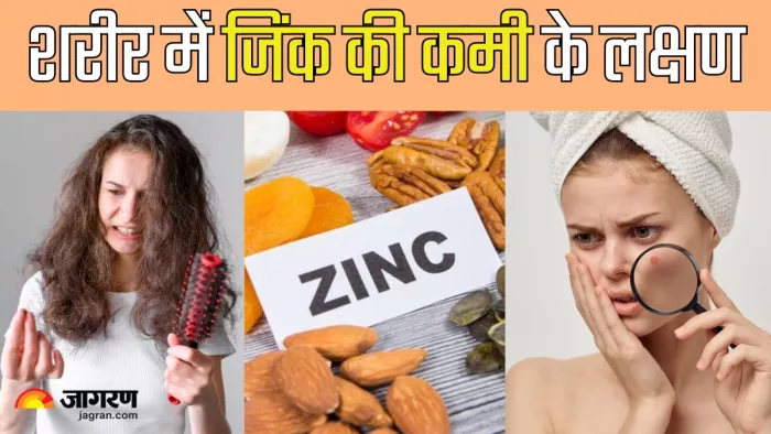 जिंक की कमी के 5 लक्षण (Picture Credit- Freepik)