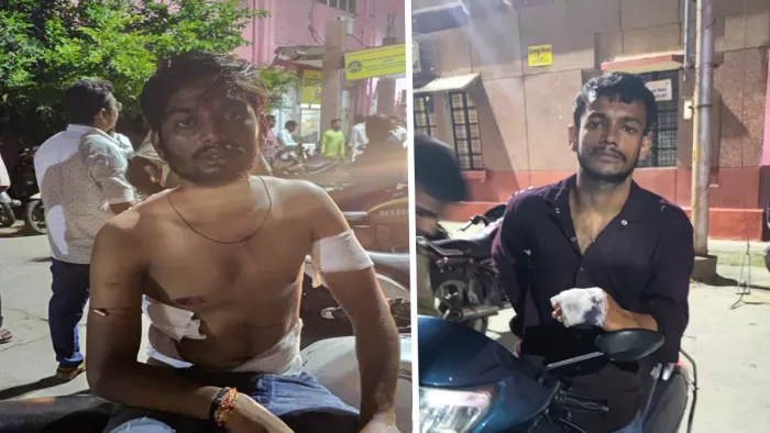 वारदात के बाद दोनों हमलावर मौके से फरार हो गए।