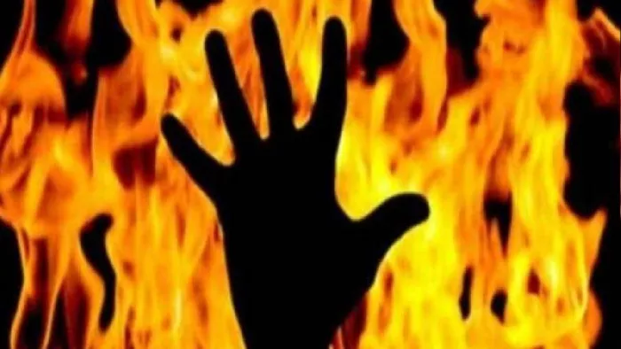 Teenage Girl burnt alive in Pilibhit: पुलिस ने आरोपित को गिरफ्तार कर लिया है। प्रतीकात्मक तस्वीर