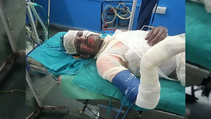 आग में झुलसे अशोक पासवान की 10वें दिन पटना में इलाज के दौरान मौत हो गई।