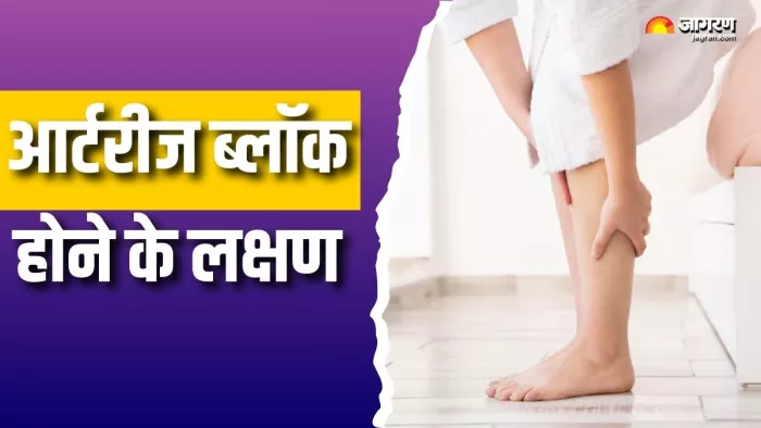 पैरों में आर्टरीज ब्लॉक होने के संकेत (Picture Courtesy: Freepik)