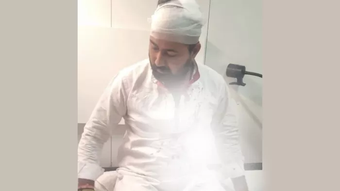 दिल्ली में बीजेपी नेता के साथ मारपीट।