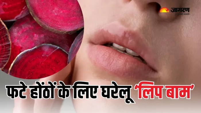 फटे होंठों के लिए रामबाण इलाज है चुंकदर का लिप बाम (Picture Courtesy: Freepik)