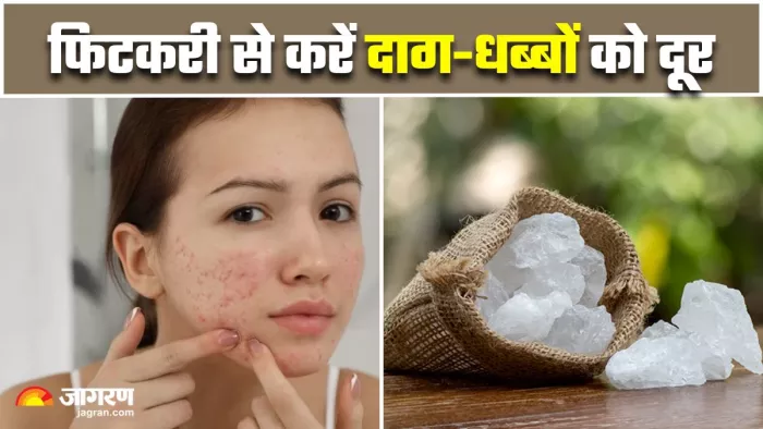 Alum For Skin: हेल्दी और ग्लोइंग स्किन के लिए इस तरीके से करें फिटकरी का इस्तेमाल (Image Source: Freepik)