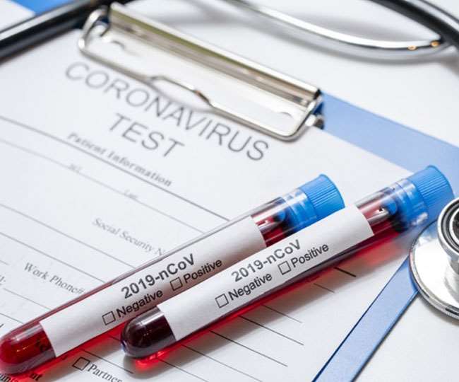 Coronavirus Tests How To Know If You Are Infected With Coronavirus