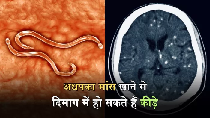 लंबे वक्त से हो रहे सिरदर्द को इग्नोर करना पड़ सकता है भारी, जानिए कैसे