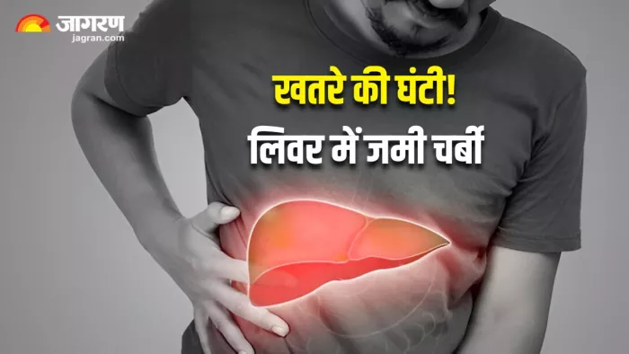 फैटी लिवर और NAFLD में क्या अंतर है? जानिए इनके खतरे और बचाव के उपाय (Image Source: Freepik)