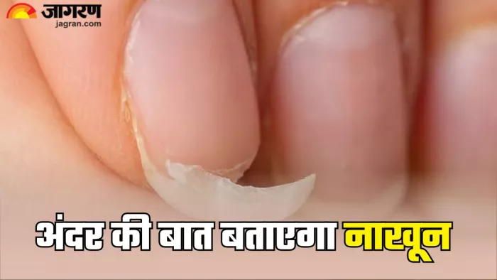 नाखूनों से समझें सेहत का हाल (Picture Credit- Freepik)