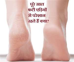 विटामिन बी-3, विटामिन ई और विटामिन सी की कमी की वजह से फटती हैं एड़िया।