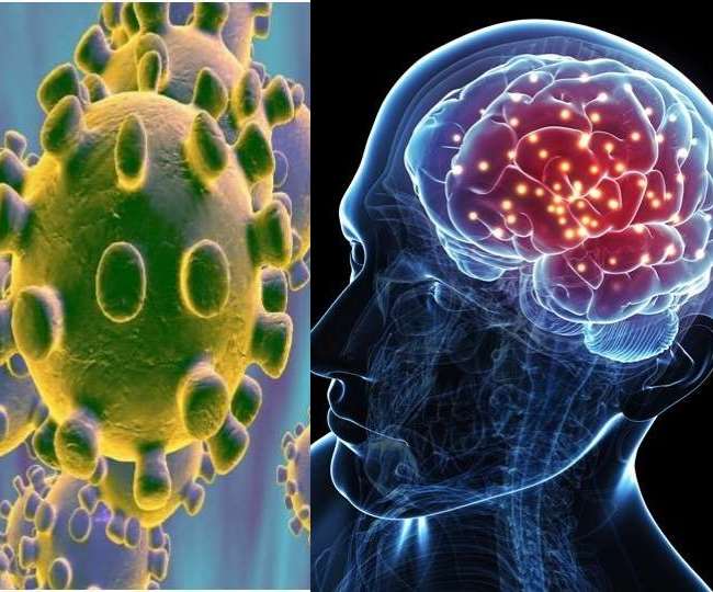 न्यूरोपैथोलॉजिस्ट पीटर डी. कैनोल और उनकी टीम ने मरीजों की मृत्यु के बाद उनके ब्रेन टिशू एकत्रित करने शुरू किए।