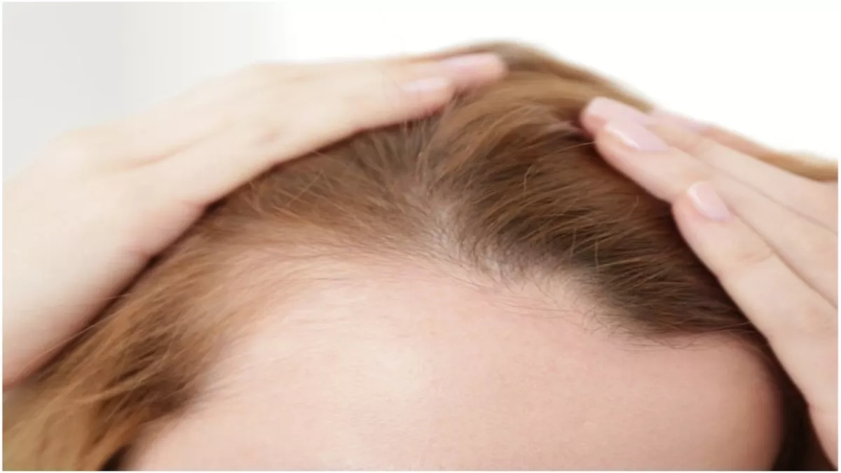 Hair fall In Women: महिलाओं में बाल झड़ने के पीछे हो सकती हैं ये 5 वजहें,  जानें कैसे इसे रोका जाए? - Reason Behind Hair fall In Women Remedies To  Stop It