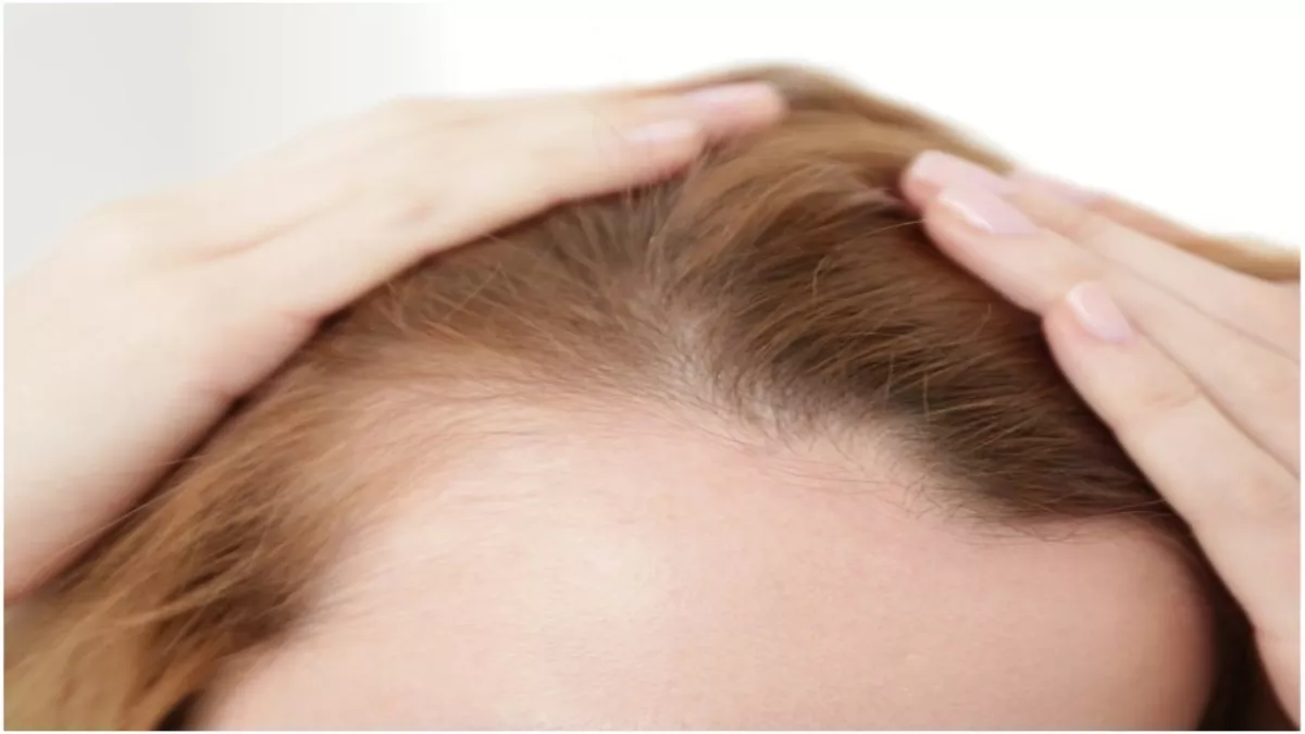 Hair fall In Women: महिलाओं में बाल झड़ने के पीछे हो सकती हैं ये 5 वजहें, जानें कैसे इसे रोका जाए? - Reason Behind Hair fall In Women Remedies To Stop It Hair fall In Women: महिलाओं में बाल झड़ने के पीछे हो सकती हैं ये 5 वजहें, जानें कैसे इसे रोका जाए? - Reason Behind Hair fall In Women Remedies To Stop It