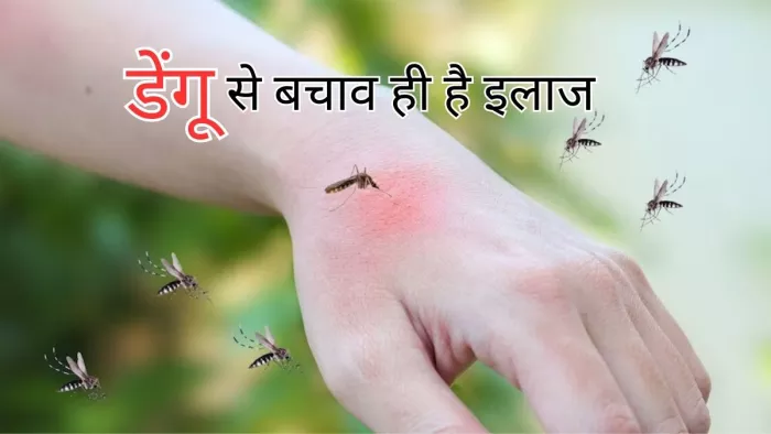 डेंगू से बचने के लिए आज ही बदलें कुछ आदतें