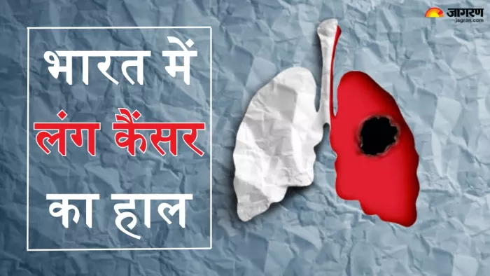 भारत में नॉन-स्मोकर्स हो रहे Lung Cancer का शिकार (Picture Credit- Freepik)