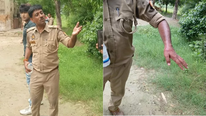वारंटी के घर पर चौकी प्रभारी द्रिवेश त्रिवेदी और चोटिल हाथ दिखाते चौकी प्रभारी
