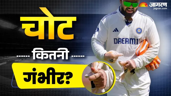ऋषभ पंत की अंगुली में लगी चोट।