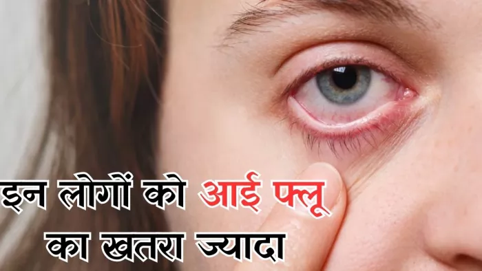 इन लोगों का ज्यादा है आई फ्लू का खतरा