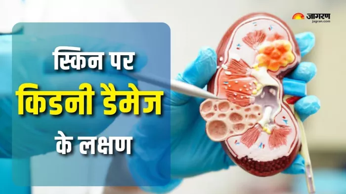 किडनी डैमेज होने पर दिखाई देते हैं ये लक्षण (Picture Courtesy: Freepik)