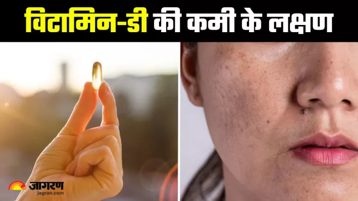 क्या आपकी Skin भी दे रही है Vitamin-D की कमी का संकेत? (Image Source: Freepik)