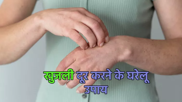 Home Remedies for Itching: खुजली की समस्या दूर करने में मददगार है ये घरेलू उपाय