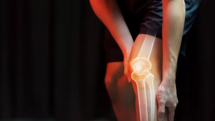 World Arthritis Day 2023: गठिया के मरीजों के लिए जहर हैं ये फूड्स