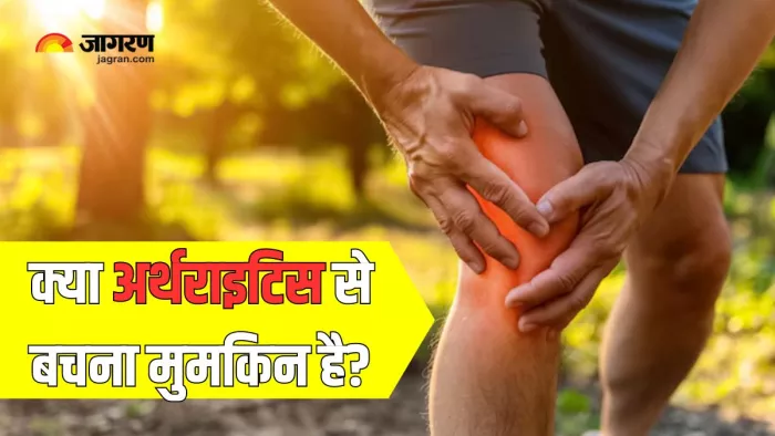 डॉक्टर से जानें अर्थराइटिस से बचाव के तरीके (Picture Courtesy: AI Generated/ Freepik)