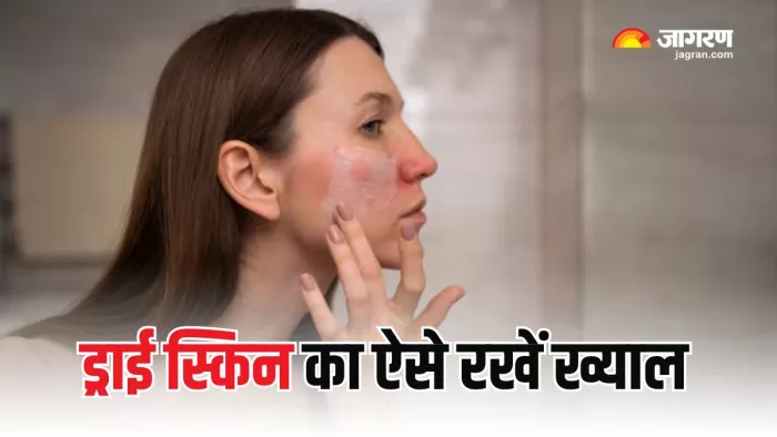 ठंडी हवाएं बना सकती है आपकी स्किन को रूखा और बेजान (Picture Courtesy: Freepik)