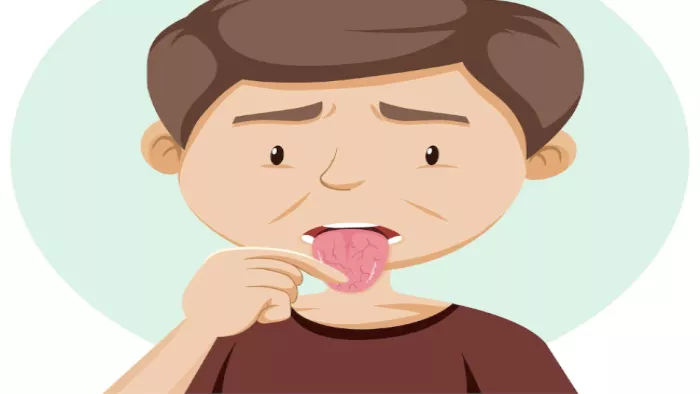 Dry Mouth Problems: मुंह सूखने की वजहें, कारण व बचाव