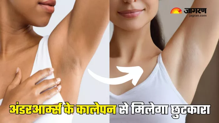 Underarms की डार्कनेस दूर करने के लिए आजमाएं ये नुस्खे (Picture Courtesy: Freepik)