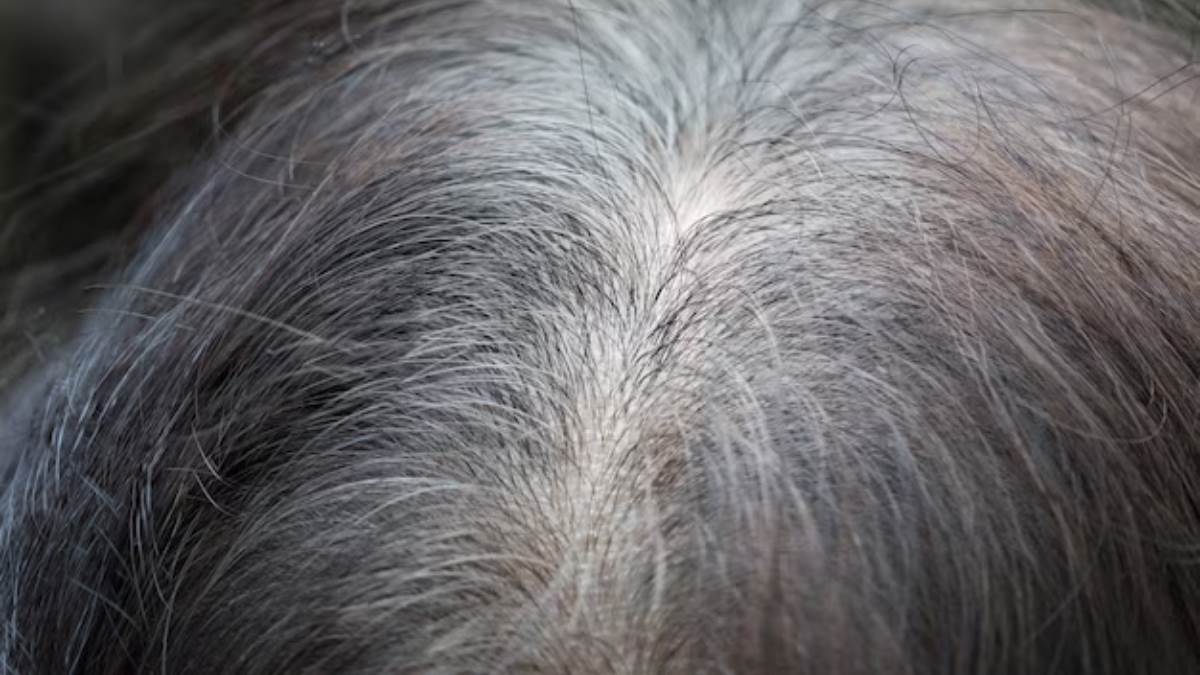https://www.jagranimages.com/images/newimg/12062023/12_06_2023-grey-hairs_1_23439326.jpg