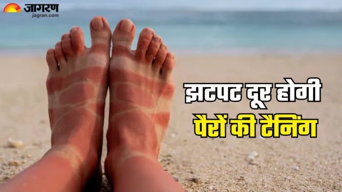 पैरों की टैनिंग दूर करेगा ये उपाय (Picture Credit- Freepik)