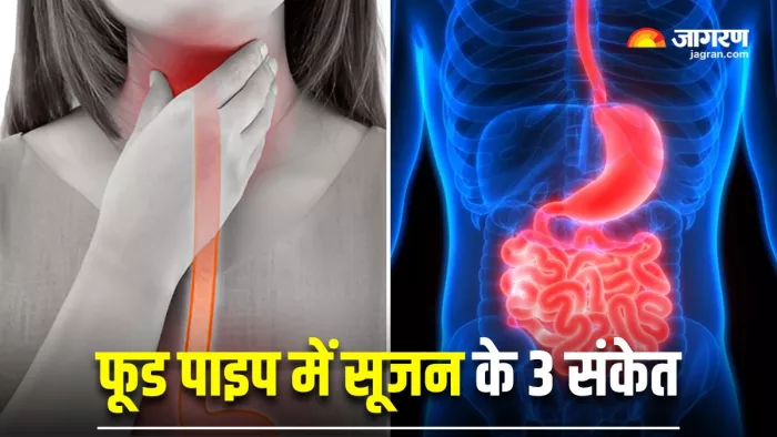 फूड पाइप में इन्फ्लेमेशन के 3 संकेत (Image Source: Freepik)