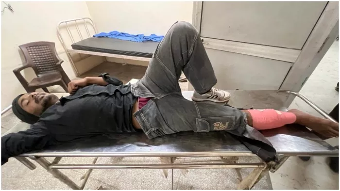 अमृतसर में पुलिस और लुटेरे के बीच मुठभेड़, टांग में गोली लगने से घायल हुआ आरोपित