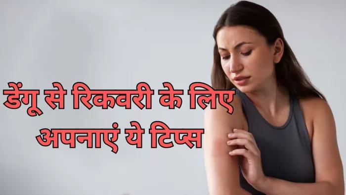 डेंगू से रिकवरी के लिए अपनाएं ये टिप्स