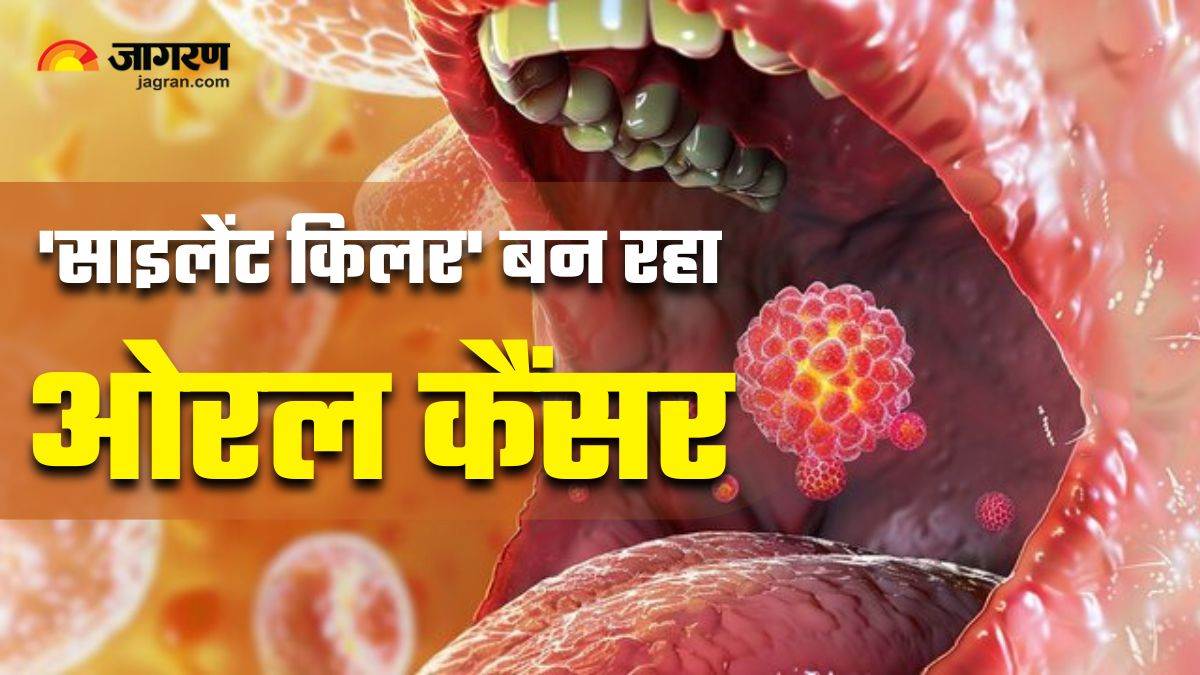 https://www.jagranimages.com/images/newimg/12092025/12_09_2025-oral_cancer_24044109_9850858.jpg