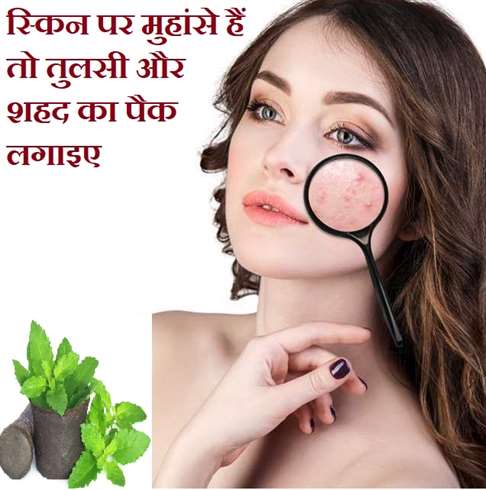 effective homemade holy basil and honey pack for clear skin know the recipe and benefits