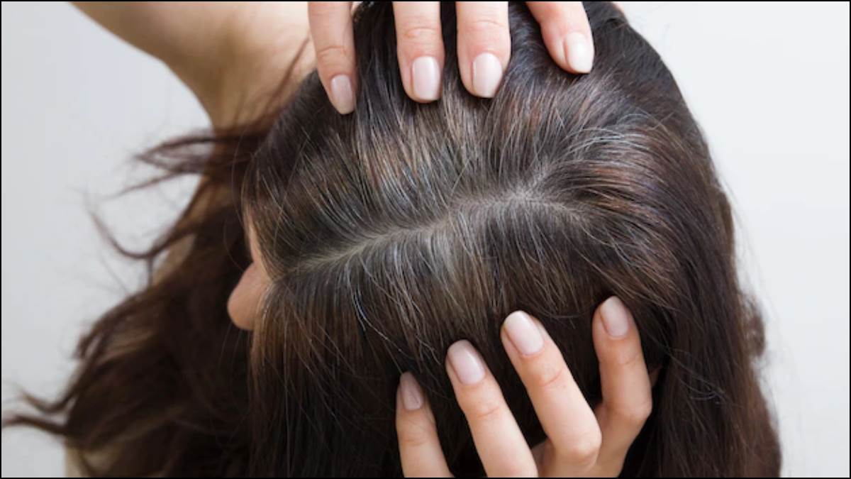 Hair Care Tips: उम्र से पहले ही सफेद होने लगे हैं बाल, तो इन विटामिन्स की मदद से पाएं इस समस्या से छुटकारा - Hair Care Tips for white hairs add these vitamins in your diet of get rid of early age hair whitening