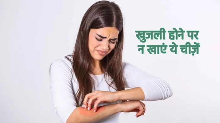 Foods to Avoid in Eczema: खुजली होने पर न खाएं ये चीज़ें
