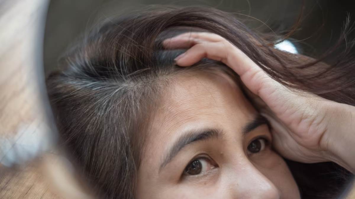 https://www.jagranimages.com/images/newimg/13012024/13_01_2024-gray_hairs_23628023.jpg