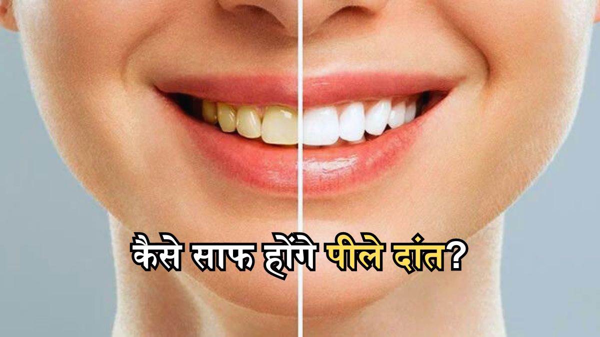 teeth whitening home remedies in hindi piley dant kaise saaf kare