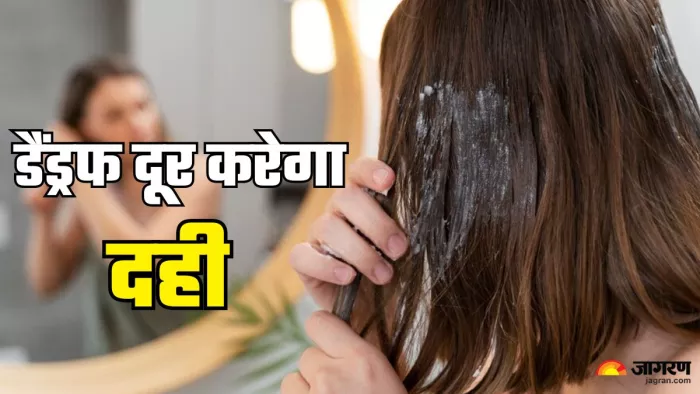 डैंड्रफ की समस्या दूर करेगा दही (Picture Credit- Freepik)