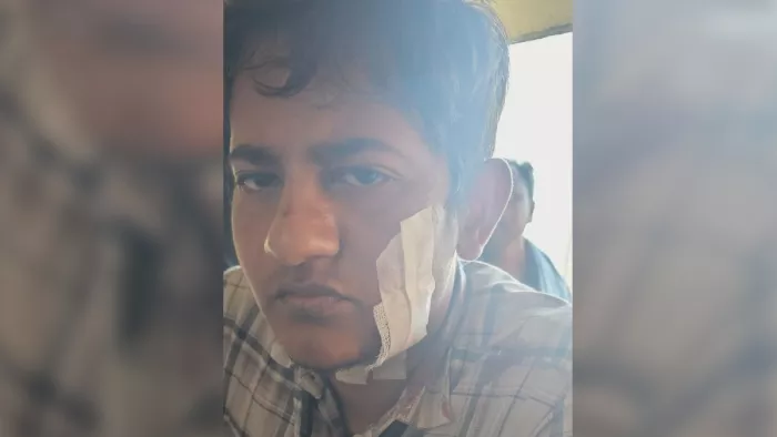 Bihar Bijli : बिजली चोरी की जांच से भड़के ग्रामीण; अफसरों को दौड़ा-दौड़कर पीटा, 50 अज्ञात पर FIR दर्ज