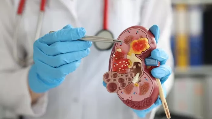 Kidney Damage: डायबिटीज और हाइपरटेंशन हैं किडनी के दुश्मन (Picture Courtesy: Freepik)