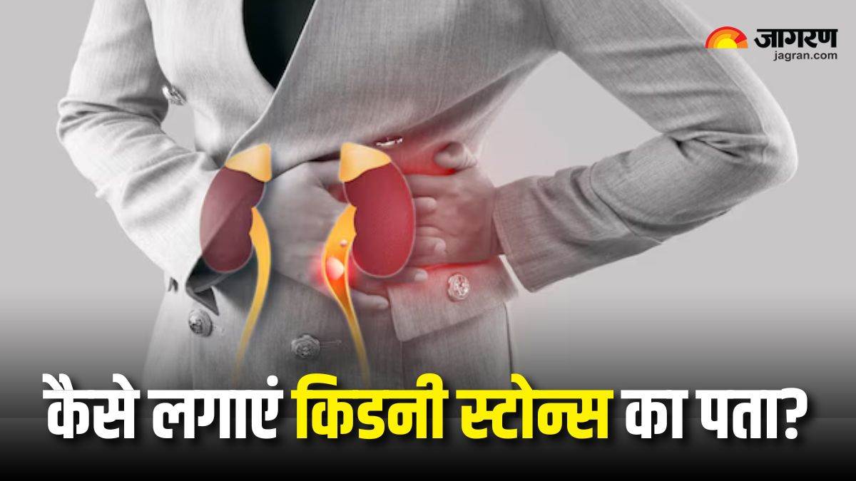 https://www.jagranimages.com/images/newimg/13032025/13_03_2025-kidney_stones_symptoms_23899308.jpg