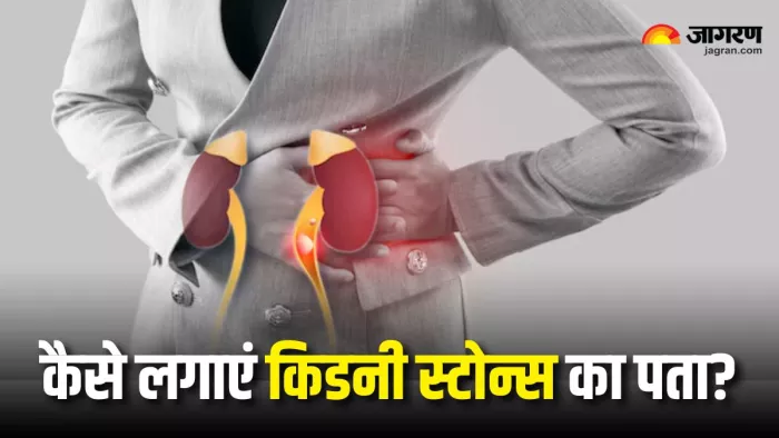 Kidney Stones: किडनी स्टोन्स से बचने के लिए क्या करना चाहिए? (Picture Courtesy: Freepik)