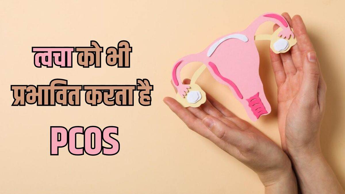 https://www.jagranimages.com/images/newimg/13042024/13_04_2024-pcos_4_23695936.jpg
