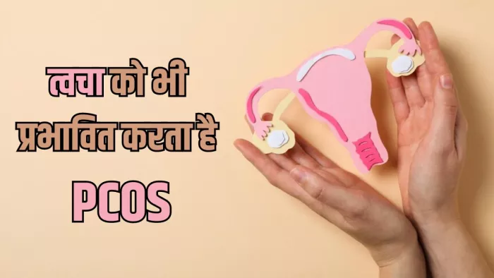 सेहत ही नहीं त्वचा को भी प्रभावित करता है PCOS