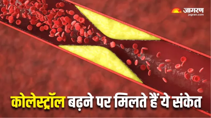 High Cholesterol Signs: कोलेस्ट्रॉल बढ़ने पर शरीर में दिखते हैं ये संकेत (Picture Courtesy: Freepik)