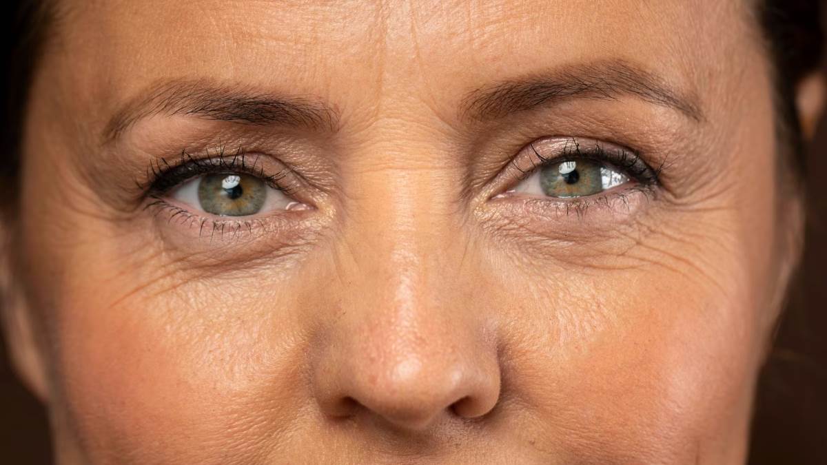 https://www.jagranimages.com/images/newimg/13052023/13_05_2023-eye_wrinkes_remedies_f_23410297.jpg