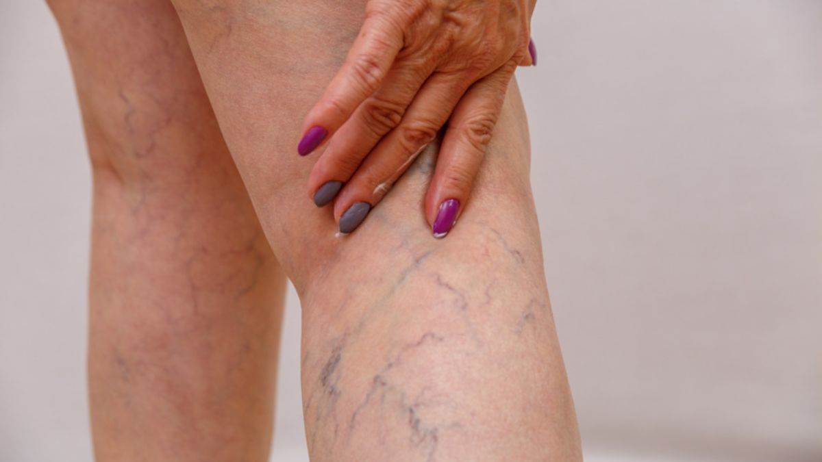 https://www.jagranimages.com/images/newimg/13052025/13_05_2025-why_blood_is_red_but_veins_blue_23936878.jpg